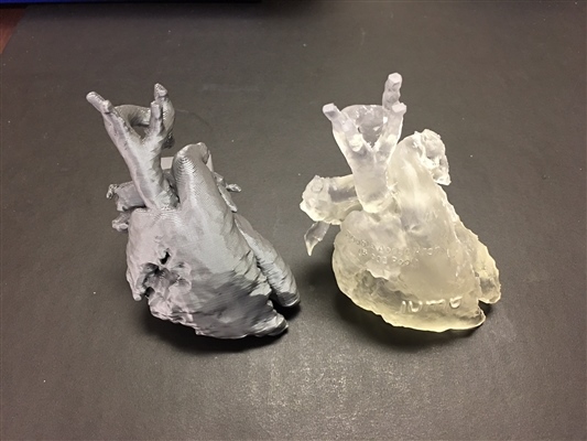 Hearts showing Blood Pool Volume Double Aortic Arch PLA on FDM Printer vs Clear resin on SLA Printer