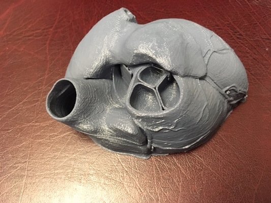 Grey PLA heart showing pulmonary valve