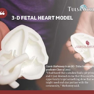 3-D Fetal Heart Model